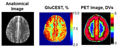 When comparing GluCEST imaging (middle panel) of healthy human brains with other methods (PET), more details in the landscape of white matter (green/yellow) and gray matter (red) of the whole brain were revealed using the GluCEST method. Ravinder Reddy, PhD, Perelman School of Medicine; Nature Medicine